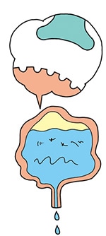 神経因性膀胱イメージ