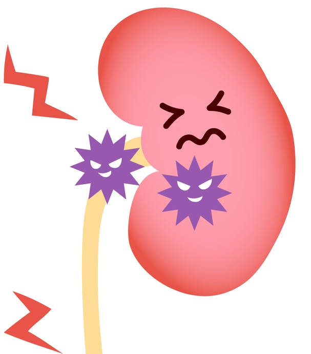 腎盂腎炎イメージ