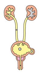 尿管結石症イメージ